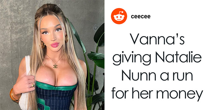 Love Island Contestants’ Overfilled Faces Fuel Concerns Over Filler Use In Young Adults