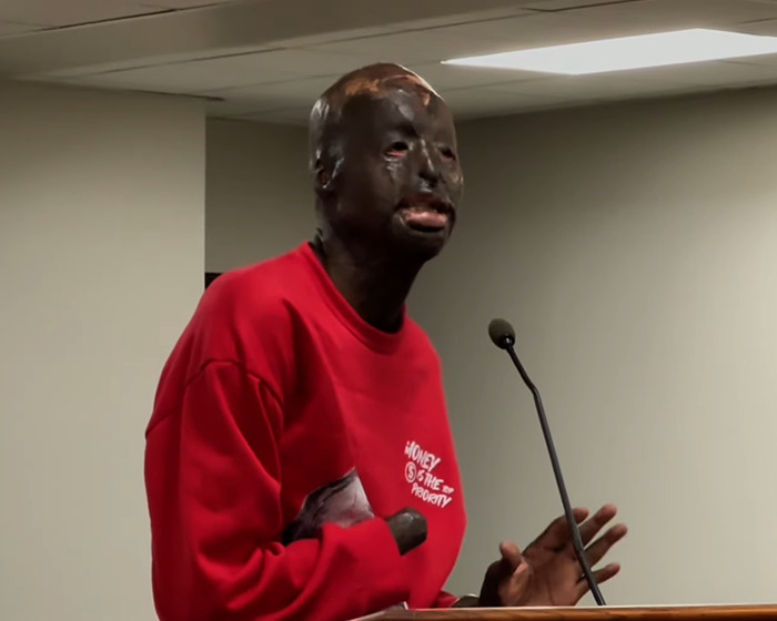 Man with severe burn scars wearing red sweatshirt speaks at podium, linked to Batman villain story and homicide case.