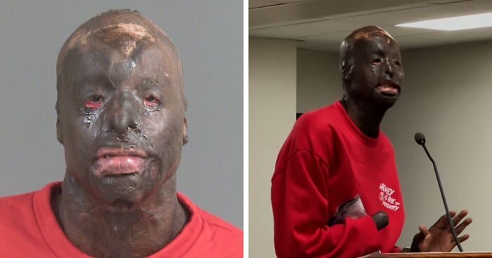 17-Year-Old Fatally Shot, Main Suspect Turns Himself In But His Appearance Stuns People