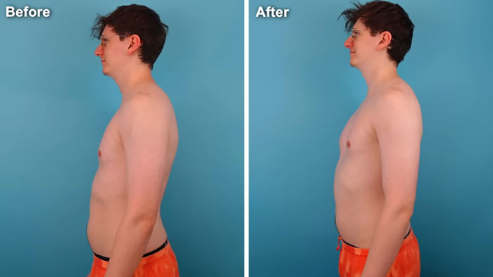 Man Walks 250K Steps In 7 Days, And The Aftermath Wasn&rsquo;t What He Expected