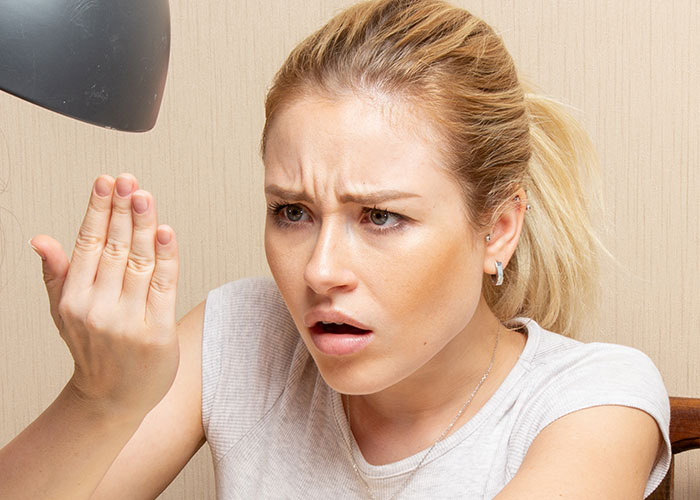 Young woman examining skin on hand with concern, illustrating cases where doctors got diagnosis wrong.