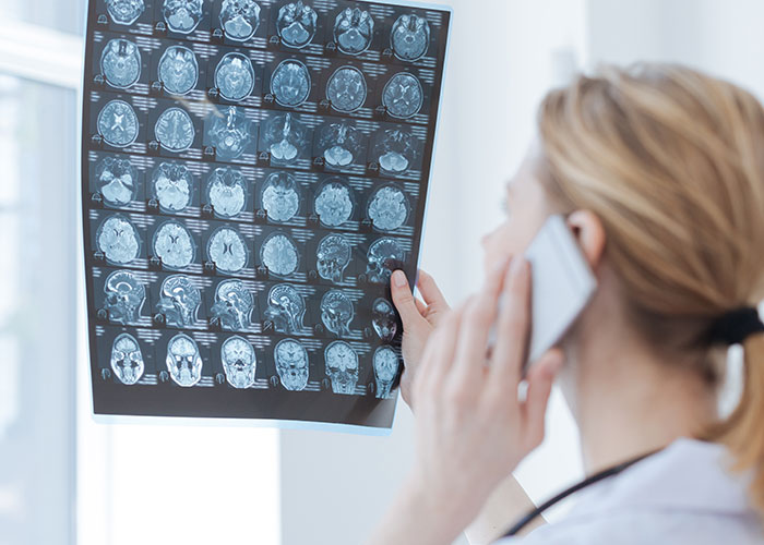 Doctor examining brain scans while on phone call, highlighting cases where doctors got diagnoses wrong.
