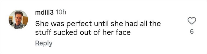 Comment stating she was perfect until having all the stuff sucked out of her face in a casual social media post. - 24