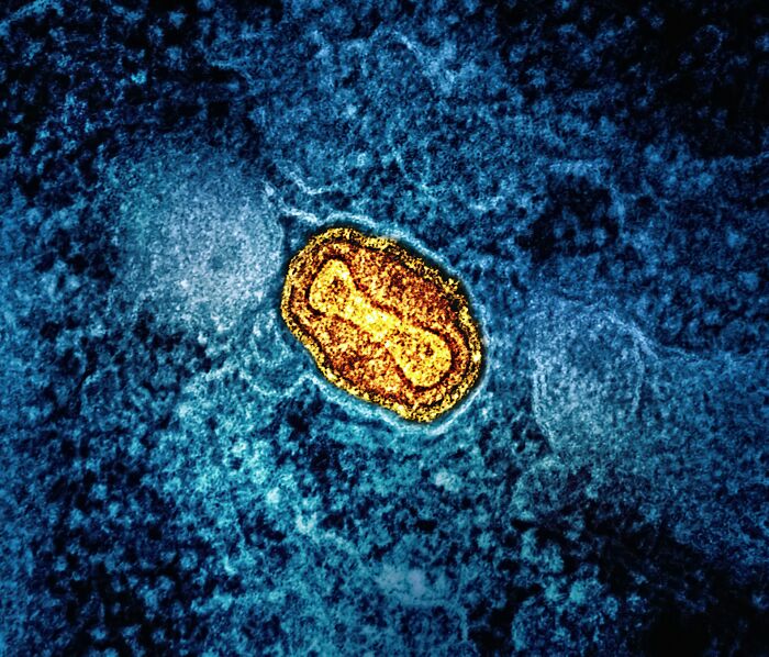 Close-up microscopic image highlighting virus structure related to tired of bad news and good news bits concept.