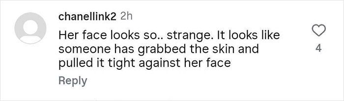 Comment on Meghan Trainor’s skinnier appearance and public debate about her body, highlighting changes in her face. Comment on Meghan Trainor’s skinnier appearance and public debate about her body, highlighting changes in her face.