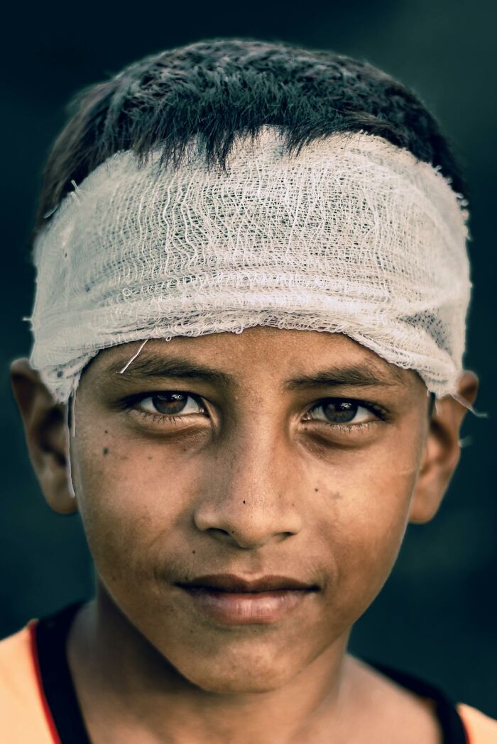 Close-up of a boy with a head bandage, representing heartwarming, ridiculous, and harmless secrets people keep private.