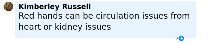 Comment from Kimberley Russell explaining red hands may indicate circulation problems linked to heart or kidney issues. Comment from Kimberley Russell explaining red hands may indicate circulation problems linked to heart or kidney issues.