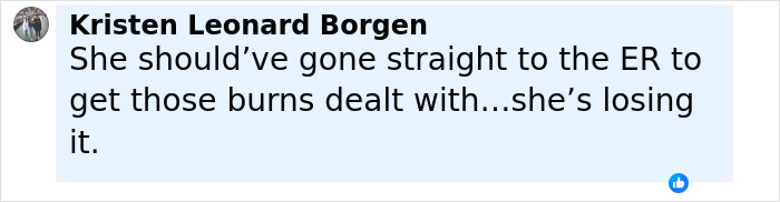 Comment from Kristen Leonard Borgen expressing concern over Brandi Glanville&rsquo;s chemical burns and urging ER visit to treat burns.