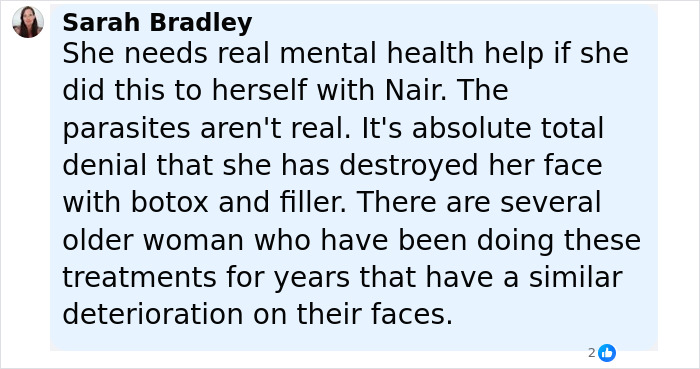 Comment by Sarah Bradley discussing Brandi Glanville's chemical burn and facial deterioration from botox and filler treatments.