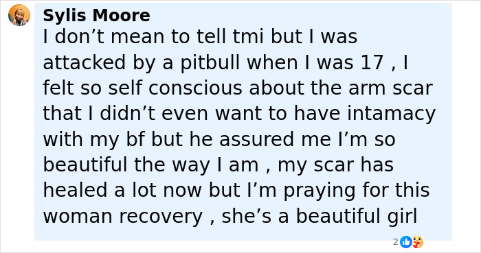 Comment from Sylis Moore sharing her experience being mauled by a dog and praying for the teen daughter's recovery.