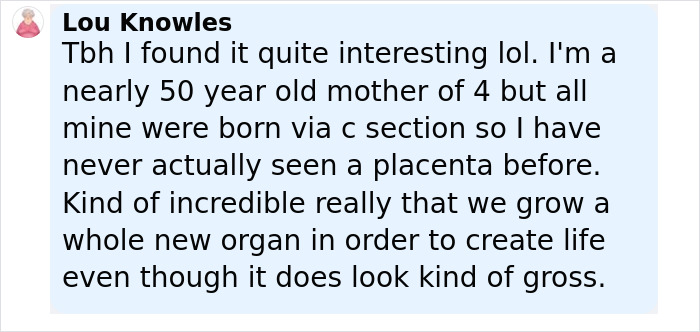 Screenshot of a user comment discussing the placenta and encapsulation process shared by Calvin Harris in a birth announcement. - 16