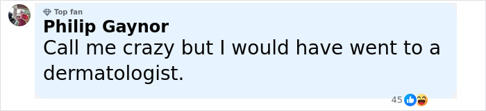 Comment from Philip Gaynor suggesting a dermatologist visit after Brandi Glanville chemically burns her face trying to remove parasite.