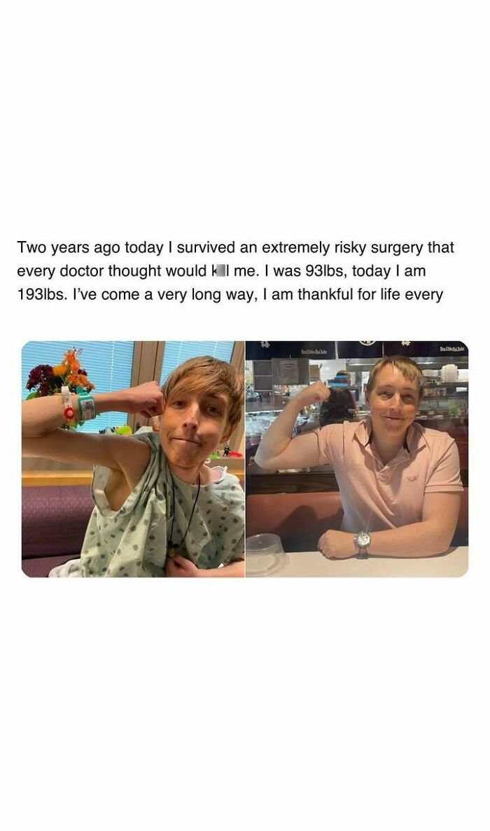 Person showing arm muscles in before and after photos, highlighting a heartwarming recovery and gratitude for life.