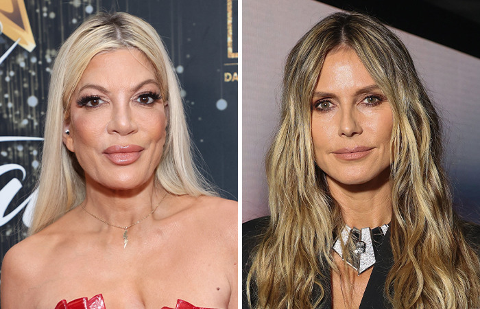 Side-by-side photos showcasing the dramatic impact of plastic surgery on celebrities born in the same year.