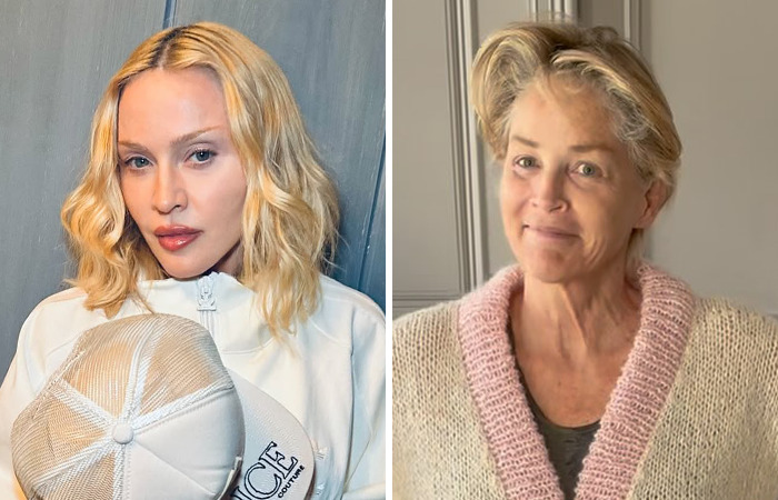Side-by-side photos showing the dramatic impact of plastic surgery on celebrities born in the same year.