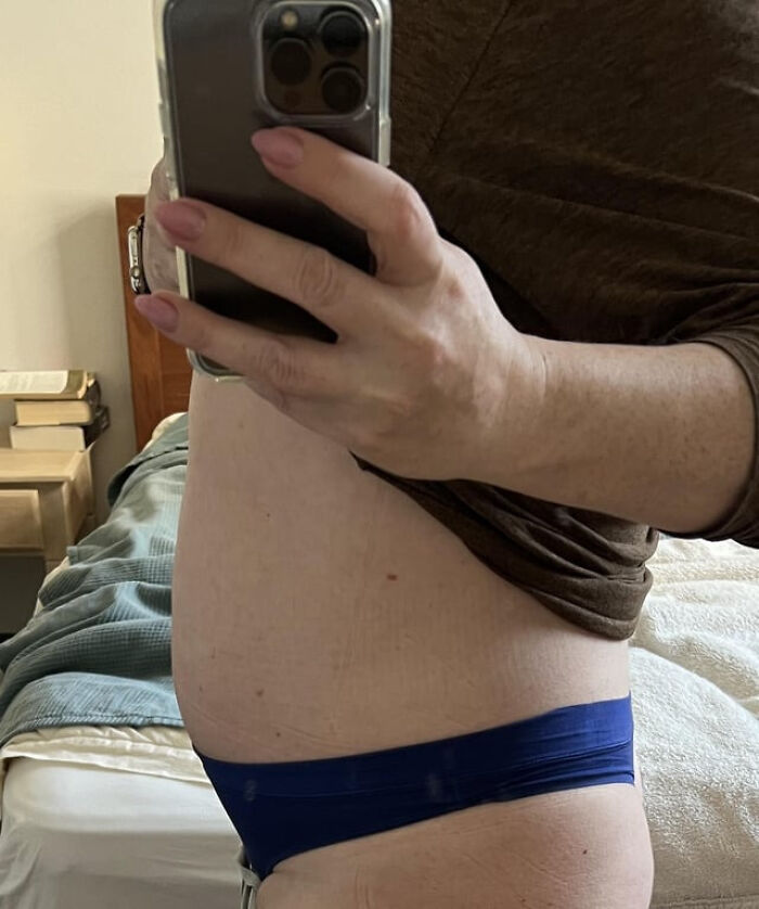 Mano sosteniendo teléfono para selfie de cuerpo humano con rasgos distintivos en piel y forma corporal.