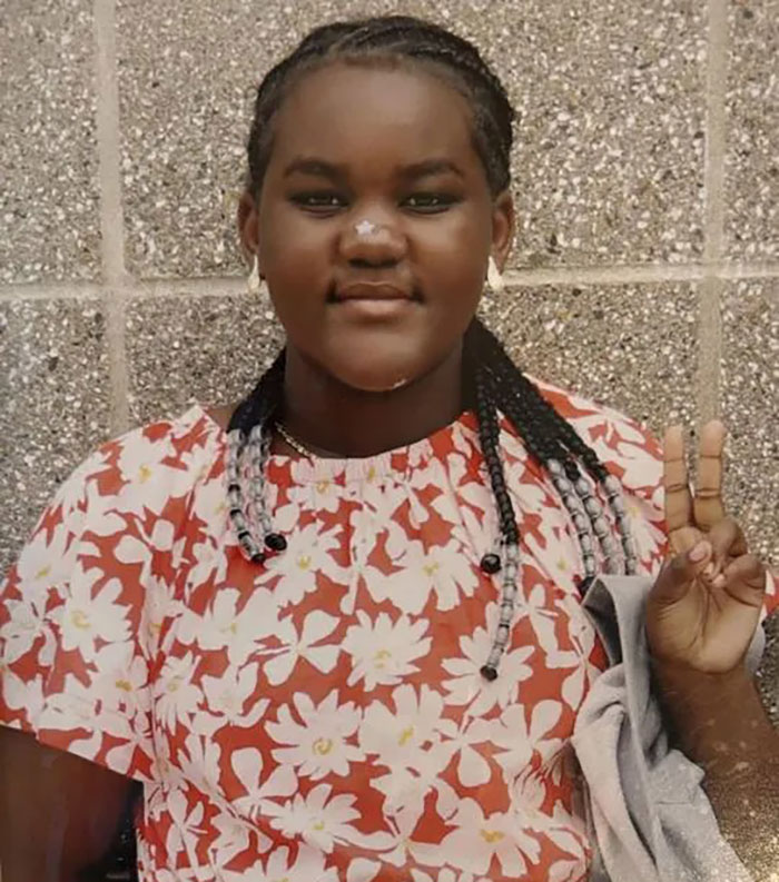 Young girl in floral dress posing with peace sign, related to hospital fires 15 nurses after patient takes own life.