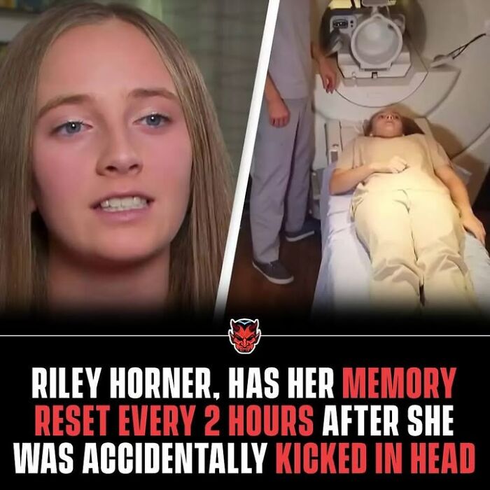 Young woman with memory reset every 2 hours lying on a medical bed, illustrating creepy facts about the brain and injury.