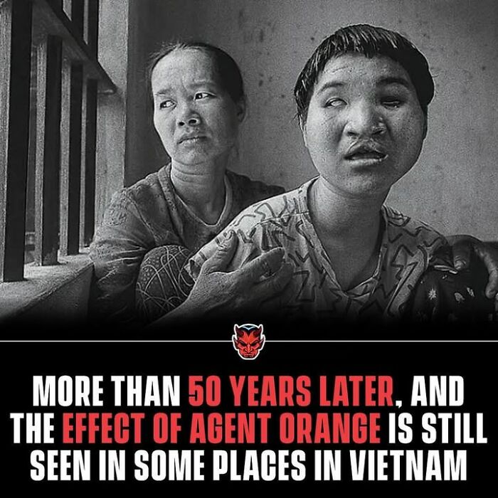 Black and white photo showing long-term effects of Agent Orange on a Vietnamese family, highlighting creepy facts about the past.