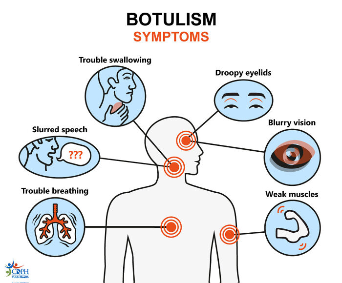 Diagram illustrating botulism symptoms including trouble swallowing, droopy eyelids, blurry vision, slurred speech, trouble breathing, and weak muscles.