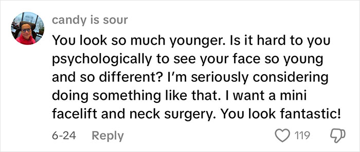 Comment praising a 51-year-old’s radical glow up after the best face lift, expressing interest in facelift and neck surgery. Comment praising a 51-year-old’s radical glow up after the best face lift, expressing interest in facelift and neck surgery.