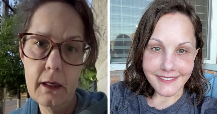 51YO Documents Progress Of Her Facelift, Leaves 125 Million People Baffled Over Results