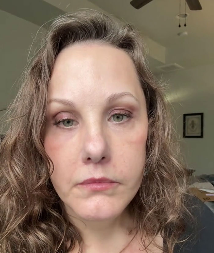 Middle-aged woman showing face lift results with a radiant glow up, highlighting dramatic and youthful facial transformation. Middle-aged woman showing face lift results with a radiant glow up, highlighting dramatic and youthful facial transformation.
