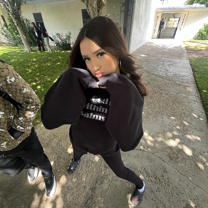 Teen daughter standing outdoors with an intense expression after being mauled by a pack of dogs.