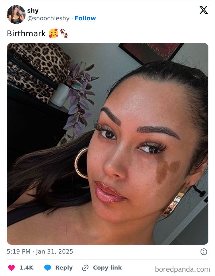 Close-up of a woman with an amazing and interesting birthmark on her cheek, wearing hoop earrings indoors.