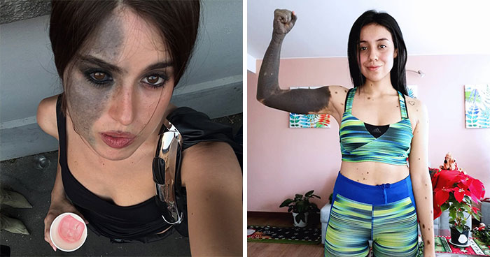 Fascinating Birthmarks Shared By People Online That You Have To See To Believe