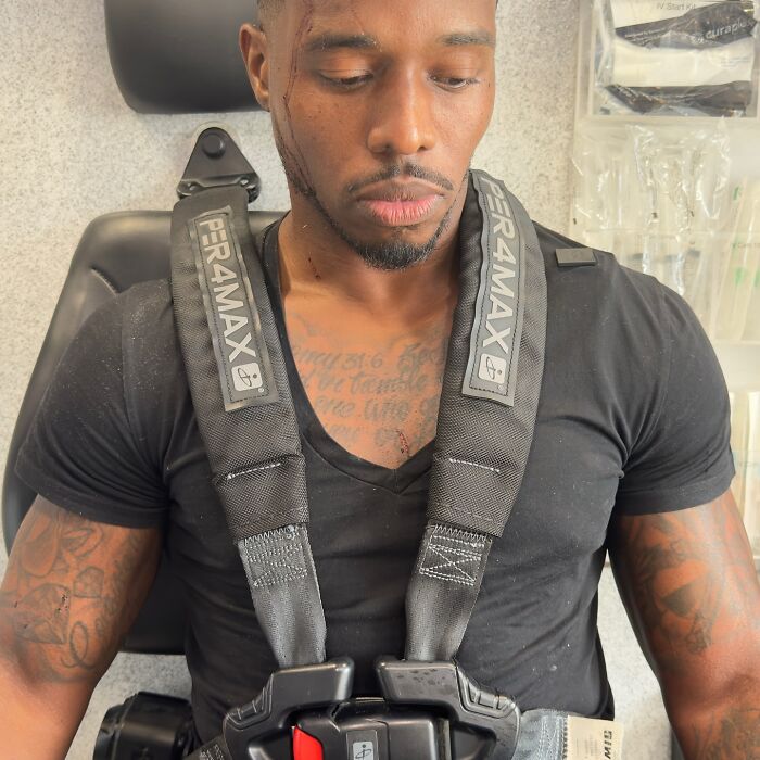 Man with blood on face and chest wearing a harness, likely injured in terrifying SUV crash at restaurant where couple was eating