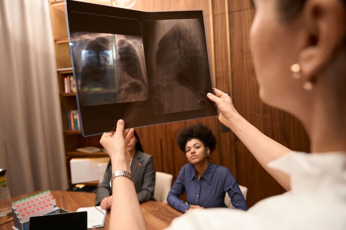 Doctor examining lung X-ray while two colleagues attentively observe, illustrating disturbing health facts that keep you awake.