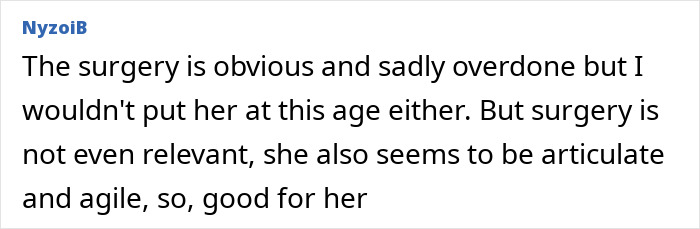 Older Kim Novak at Venice Film Festival receiving a Lifetime Achievement Award, appearing noticeably different after surgery.
