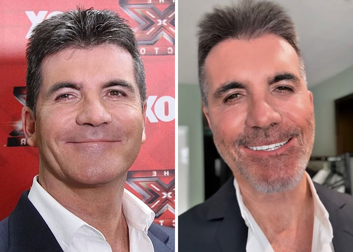 Simon Cowell pictured before and after bike accident, looking healthy and smiling in both images, raising fan concern.