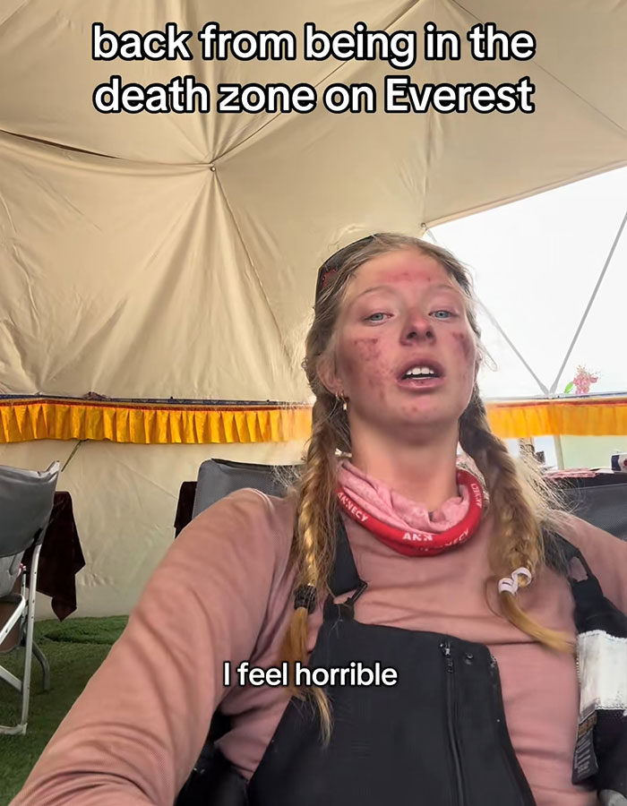 Teen severely injured after Everest climb, sparking online debate over risks of high-altitude mountaineering. Teen severely injured after Everest climb, sparking online debate over risks of high-altitude mountaineering.