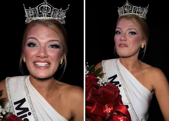 Newly crowned Miss America wearing crown and sash, holding bouquet, with noticeable makeup and concealer issues. Newly crowned Miss America wearing crown and sash, holding bouquet, with noticeable makeup and concealer issues.