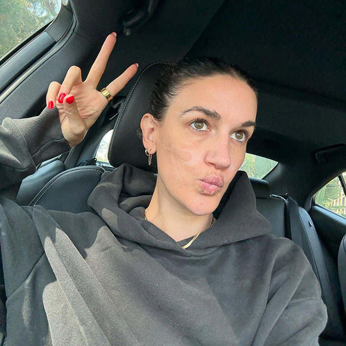 Woman in a car making a peace sign, discussing $90,000 repairs after celebrity facialist allegedly caused permanent disfigurement