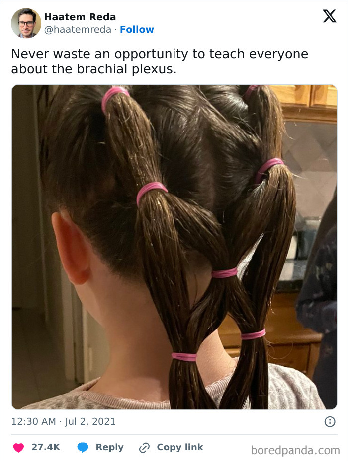 Person showing a creative hairdo resembling the brachial plexus, illustrating humor in working in medicine.