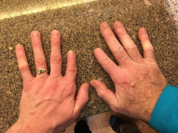 Two hands side by side on a countertop showing differences in age and skin texture in wholesome posts.