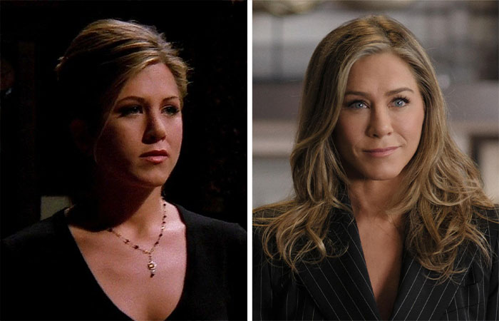 Side-by-side images of a celebrity before and after suspected buccal fat removal, highlighting facial changes.