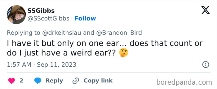 Tweet discussing a strange ear condition while questioning if it relates to the dangerous sign on Beckham's body.