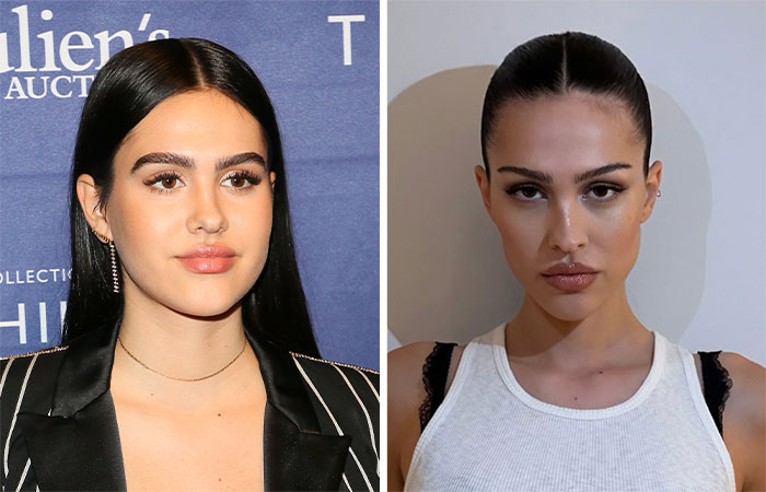 Two women shown side by side, both with sleek hairstyles and defined facial features suggesting buccal fat removal.