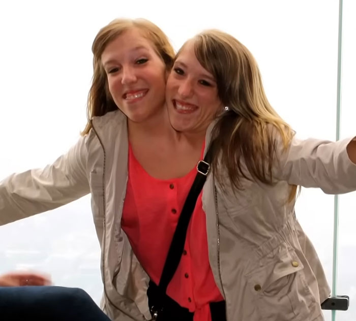 Conjoined Twins Abby And Brittany Finally Break Silence After Photos With Newborn Baby Go Viral