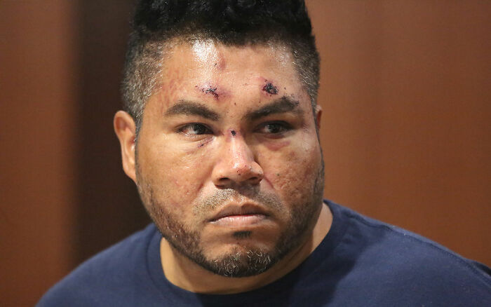 Maniac driver with facial injuries giving a shocking response to cops after running over teen who rejected advances Maniac driver with facial injuries giving a shocking response to cops after running over teen who rejected advances