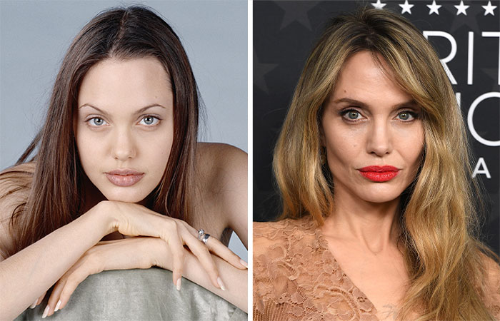 Side-by-side images of a female celebrity before and after suspected buccal fat removal, highlighting facial changes.