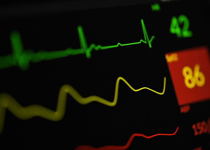 Close-up of a medical monitor showing vital signs and heart rate, highlighting a dangerous sign on Beckham's body.