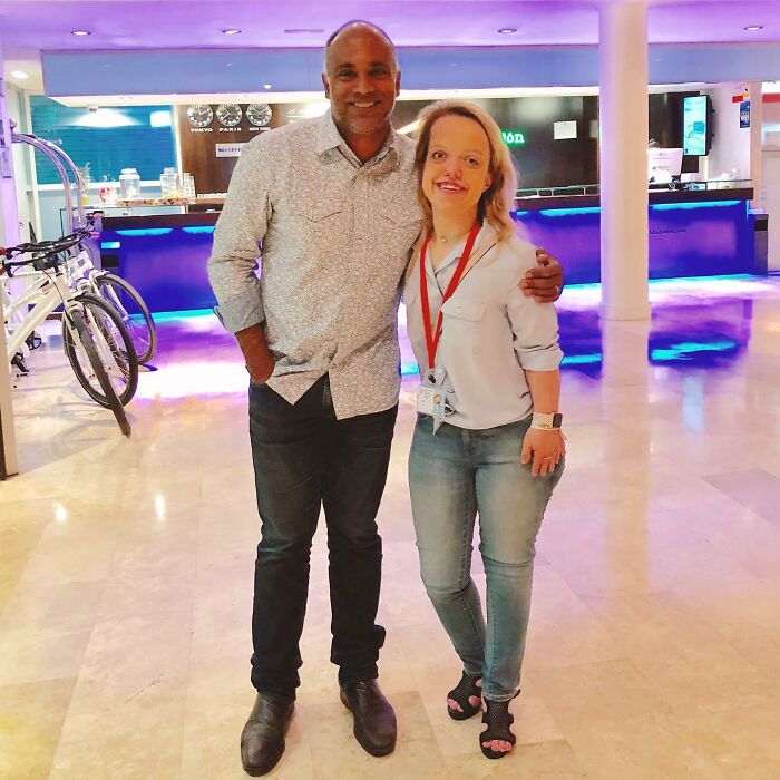 31-year-old woman with dwarfism and height surgery as a teen posing with a man in a brightly lit indoor space.