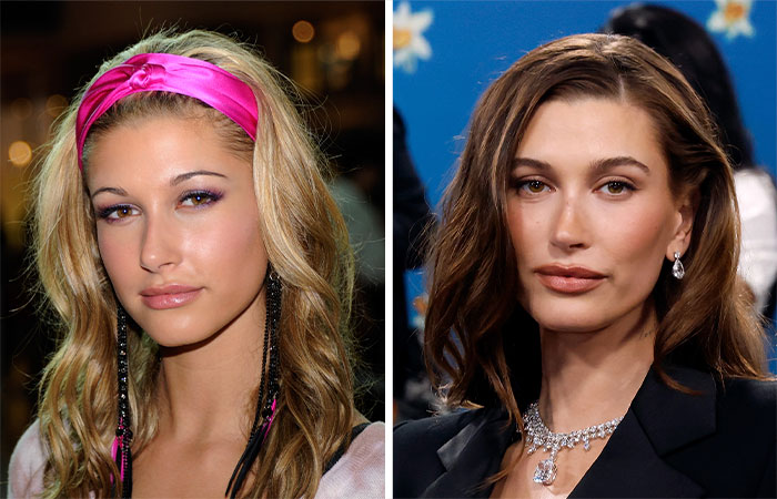 Two female celebrities with defined cheekbones, often suspected of having buccal fat removal, posing at separate events.