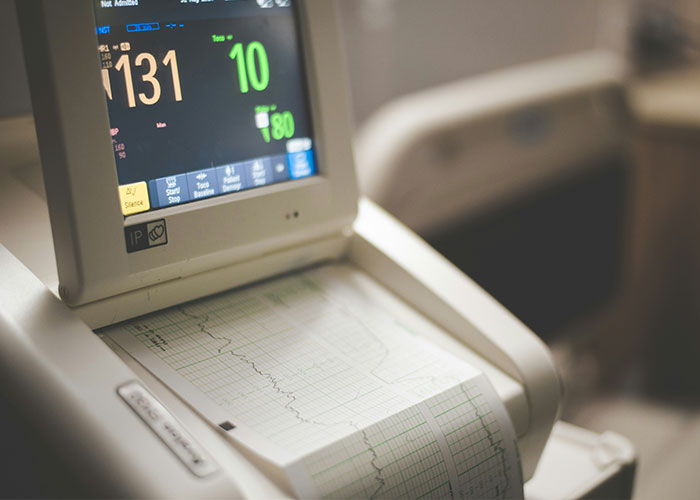 Heart monitor displaying vital signs with printed medical data, highlighting a dangerous sign on Beckham's body.