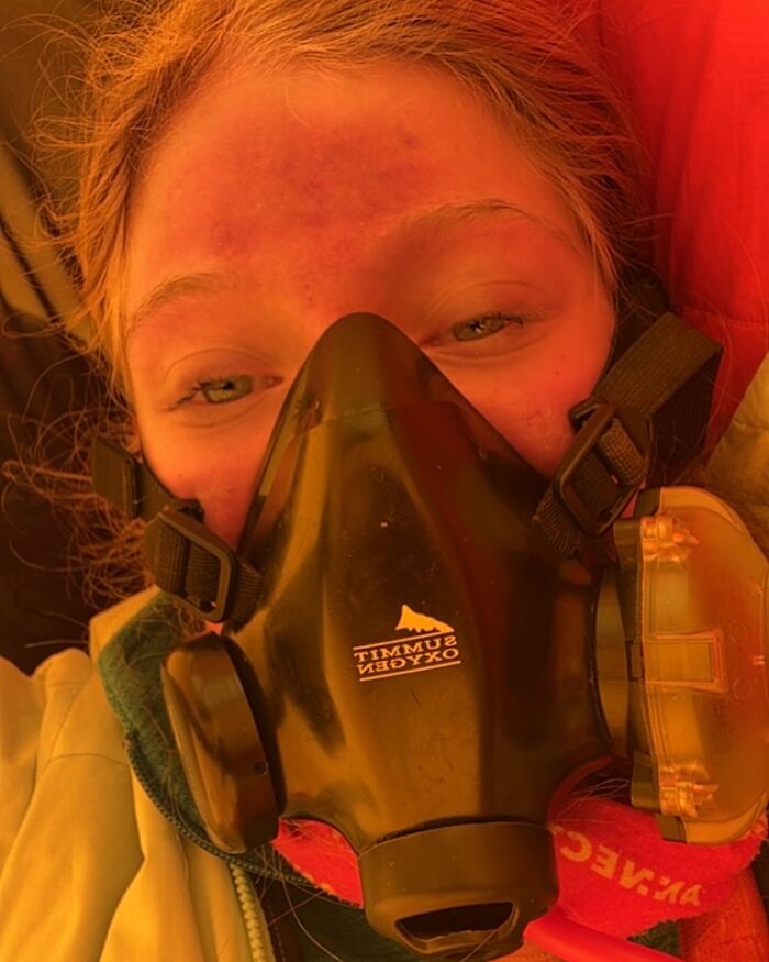 17-year-old wearing oxygen mask after severe injury from Everest climb, sparking debate about climbing risks online. 17-year-old wearing oxygen mask after severe injury from Everest climb, sparking debate about climbing risks online.